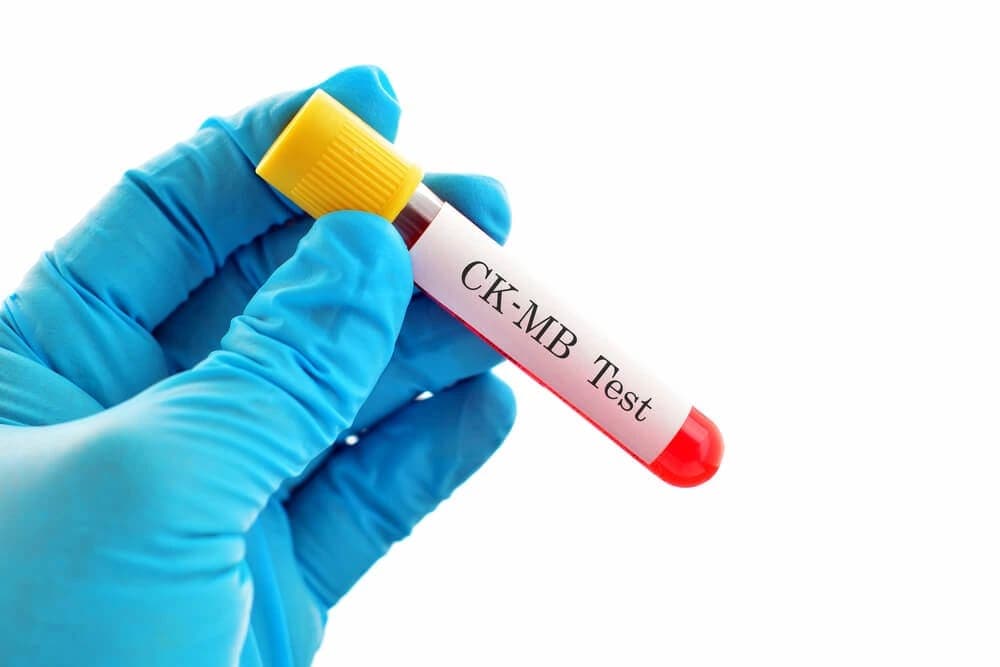 Kreatin Kinaz Nedir?