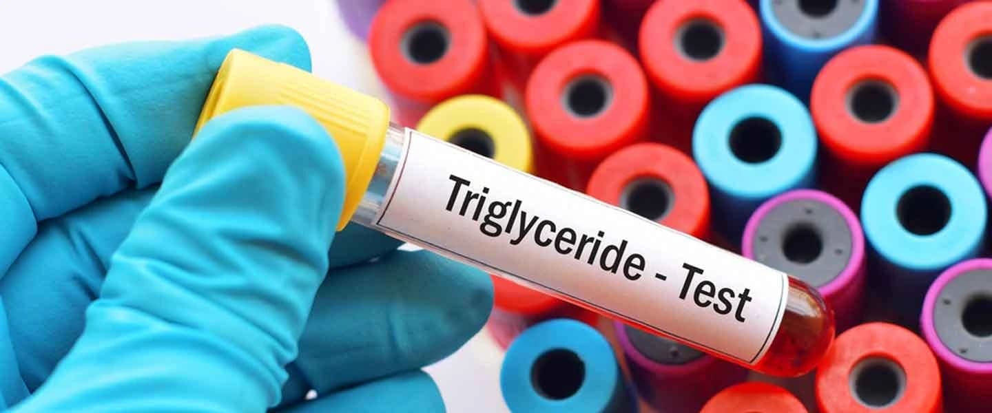 Trigliserid Nedir Ve Yükseklik Belirtileri Nelerdir?