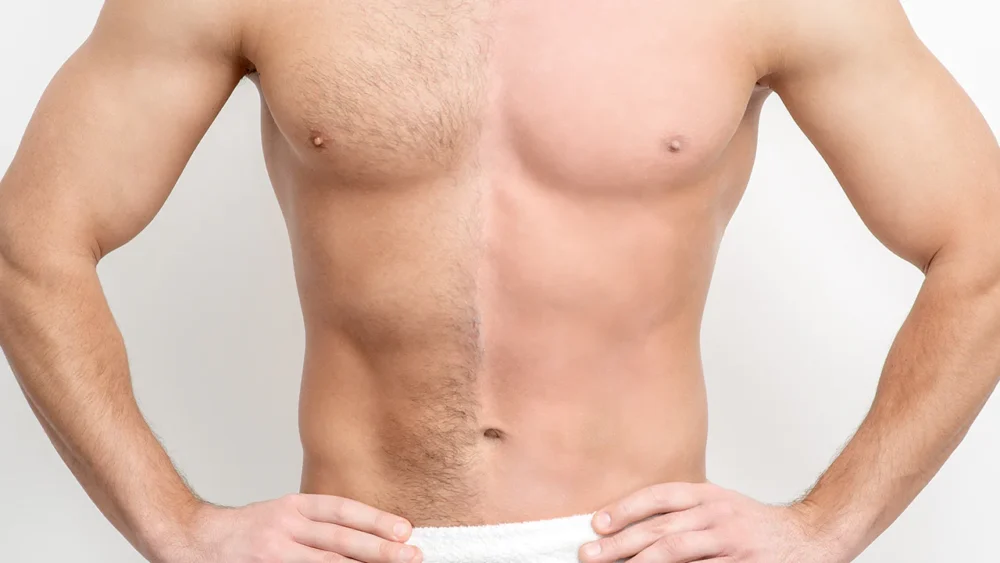 Vücut Kıllarından Kurtulma Yöntemleri 1 Vücut Kıllarından Kurtulma Yöntemleri