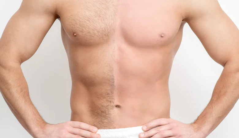 Vücut Kıllarından Kurtulma Yöntemleri