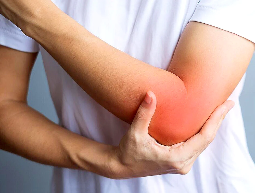 Dirsek Ağrısı Nedir? Nasıl Geçer? 1 Dirsek Agrisi