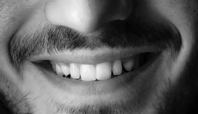 Diş Beyazlatma Zararlı Mı Zararları Nelerdir